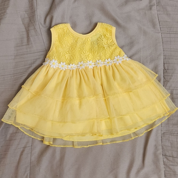 Yellow Lace Daisy Baby Dress - Picture 1 of 4